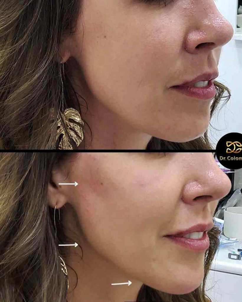 368007056_18348571660074977_9174167594878719628_n_11zon