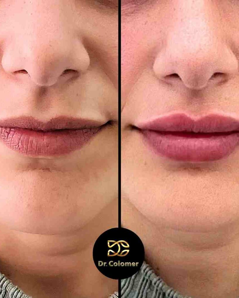 472820556_18437880928074977_6405101973017541381_n_11zon